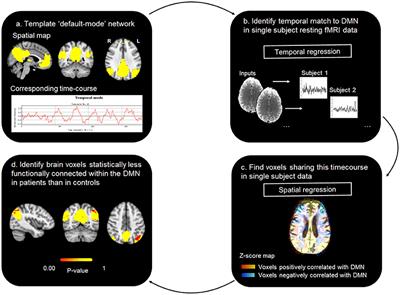 A Machine Learning Enhanced Mechanistic Simulation Framework for Functional Deficit Prediction in TBI